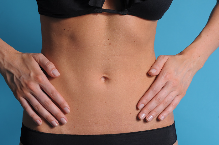 Abdominoplasty